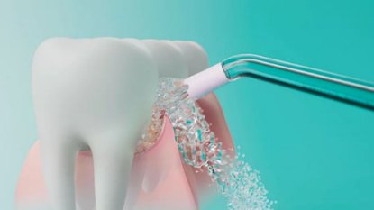 Oralni tuš PHILIPS HX3911/40, Čišćenje, Dubinsko čišćenje, Osjetljivo, bijeli